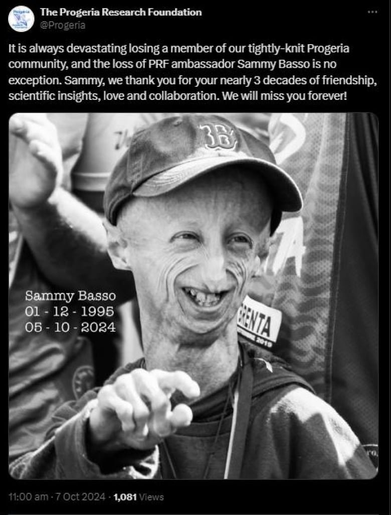 A post on X from the Progeria Research Foundation, featuring a black and white photo of a young man with a large head and wrinkled skin smiling brightly. Text on the photo reads: "Sammy Basso 01-12-1995 05-10-2024" The post reads:  "It is always devastating losing a member of our tightly-knit Progeria community, and the loss of PRF ambassador Sammy Basso is no exception. Sammy, we thank you for your nearly 3 decades of friendship, scientific insights, love and collaboration. We will miss you forever!